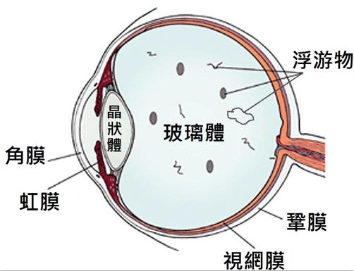 视物变形的情况严重吗？