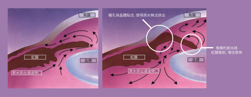 眼睛红红的，还怕光是怎么回事