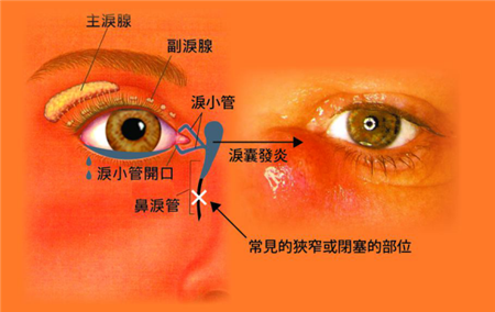 眼睛有异物感是什么原因