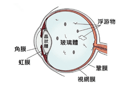 眼前有黑影是怎么回事？